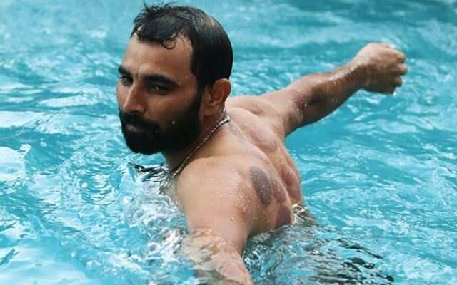 Here’s the reason why Mohammed Shami’s back is covered in reddish-black circles